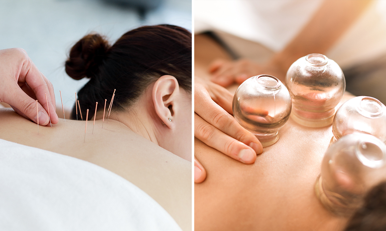 Acupunctuur Vernimmen